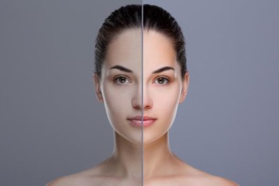 When to Combine Skin Whitening Treatment in Dubai?