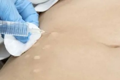Modern Lipolysis Techniques Dubai | Glamorous Clinic in Dubai