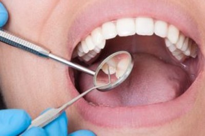 Prosthesis Solutions and the Importance of Restoring Oral Function