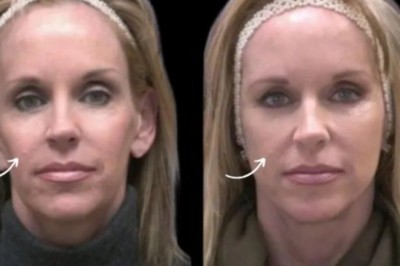 Sculptra Treatment in Dubai for Curved Feminine Silhouette