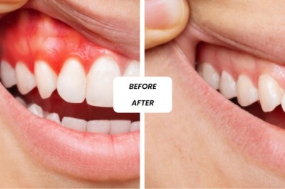 General Dentistry in Dubai: Quality Dental Services for Healthy Teeth and Gums
