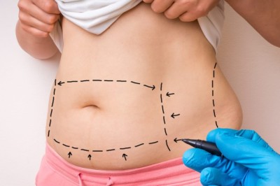 Mommy Makeover in Dubai: How to Maintain Your Results