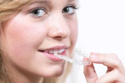 Feature Comparison of Different Types of Braces in India