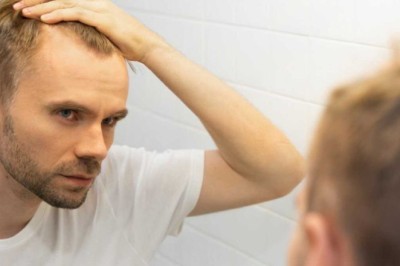 Why Are People Choosing Exosomes For Hair Loss for Results?