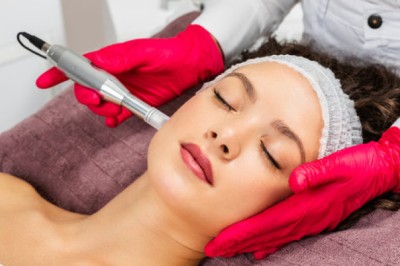 Who Is an Ideal Candidate for RF Microneedling in Dubai?