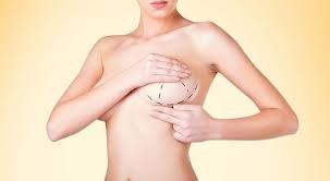 Breast Augmentation Surgery in Dubai ...